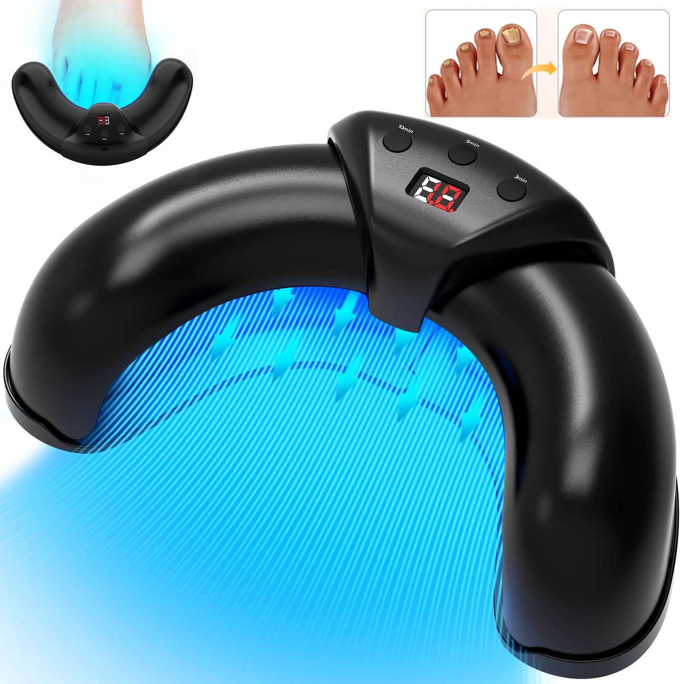 Laser for Nail Fungus Multiple Toenail 905nm470nm 7Minutes Painless Removes Calcium Nail Fungus&Ingrown toenail treatment - LKBA