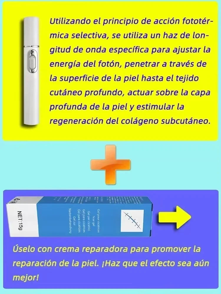 Laser Therapy Keloid Scar Improve Keloid Scar Pen Scar Relief Easy Harmless Laser Pointer - LKBA