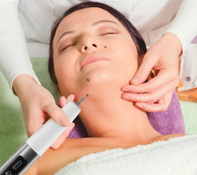 Laser Plasma Pen Black Dots Warts Remover Skin Tag Remover Mole Wart Eliminator Dark Spots - LKBA