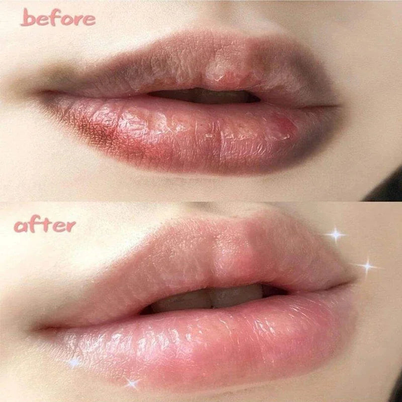 Fast Lightening Pink Lip Bleaching For Dark Lips Remove Melanin Lip Balm Sexy Rose Magic Lip Oil Whitening Moisturizing Makeup - LKBA