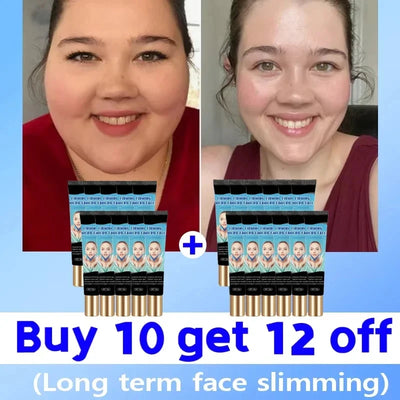 Double Chin V Shape Remove The face fat - LKBA