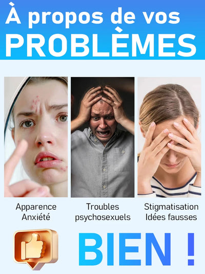 Outil Wart Blue Light, plus de réductions sur les ensembles - LKBA