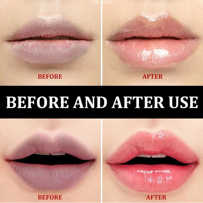 Fast Lightening Pink Lip Bleaching For Dark Lips Remove Melanin Lip Balm Sexy Rose Magic Lip Oil Whitening Moisturizing Makeup - LKBA