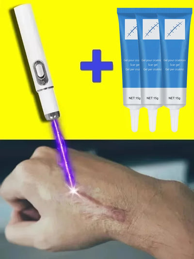 Laser Therapy Keloid Scar Improve Keloid Scar Pen Scar Relief Easy Harmless Laser Pointer - LKBA