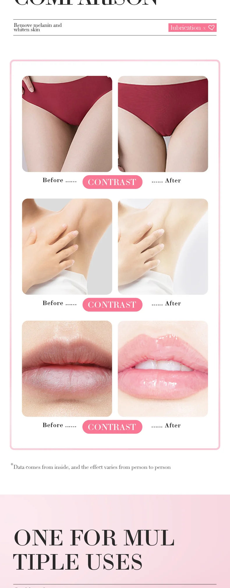 Fast Lightening Pink Lip Bleaching For Dark Lips Remove Melanin Lip Balm Sexy Rose Magic Lip Oil Whitening Moisturizing Makeup - LKBA