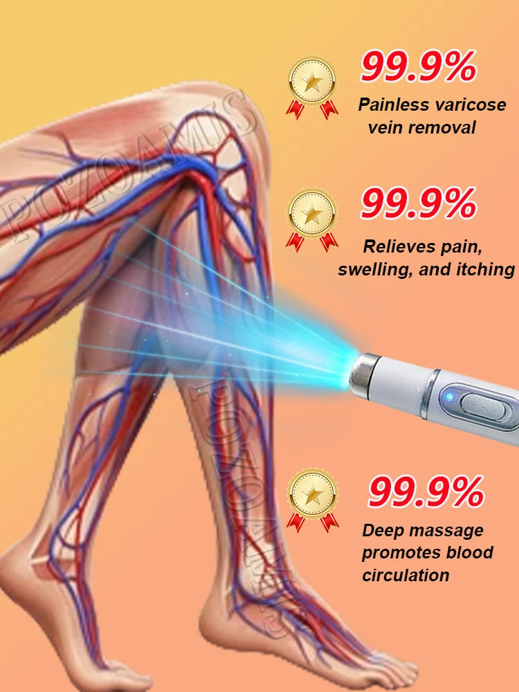 Body care, leg care tools, blue light pen, varicose veins, hot sale in 2025 - LKBA