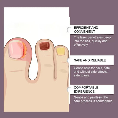 Nail repair blue light, nail care tools - LKBA