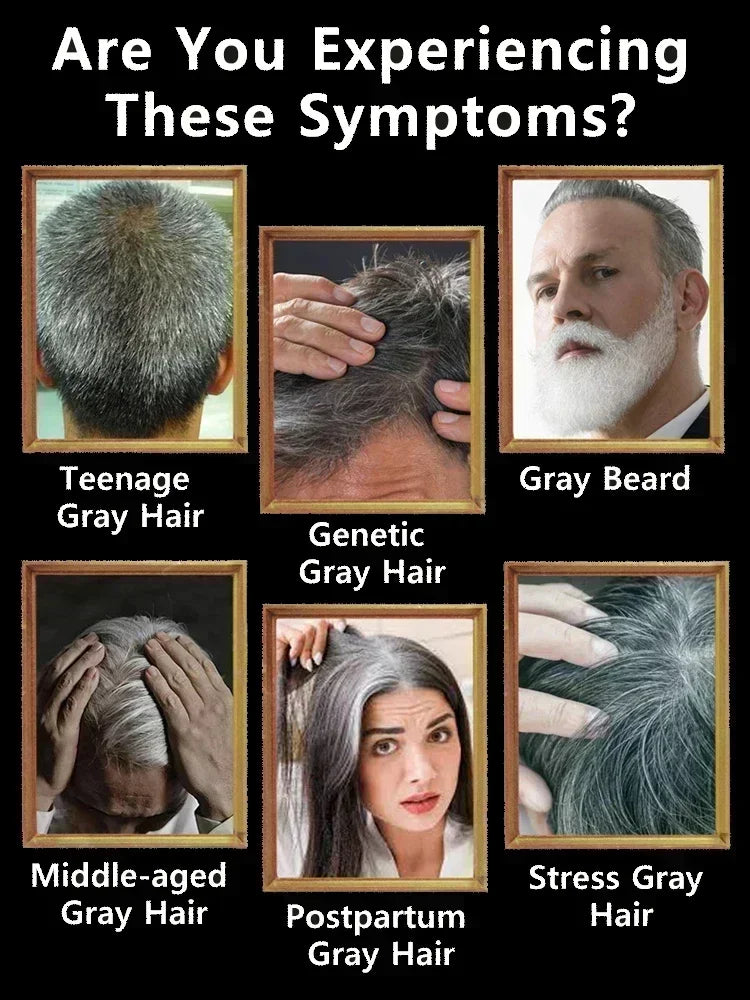 24 NEW White To Black Gray White Hair Serum Natural Color Repair Nourish Essence Anti-gray Care for Men Women - LKBA