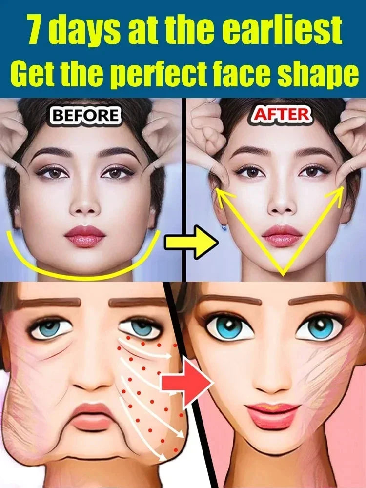 Double Chin V Shape Remove The face fat - LKBA