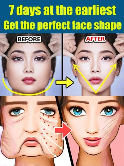 Double Chin V Shape Remove The face fat - LKBA