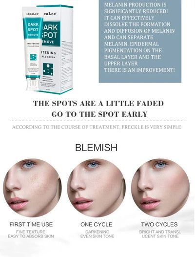 Melasma Brightening Face Cream Niacinamide Serum Brighten Cream Fade Fine Lines Lighten Dark Dot Reduce Melanin Face Skincare - LKBA