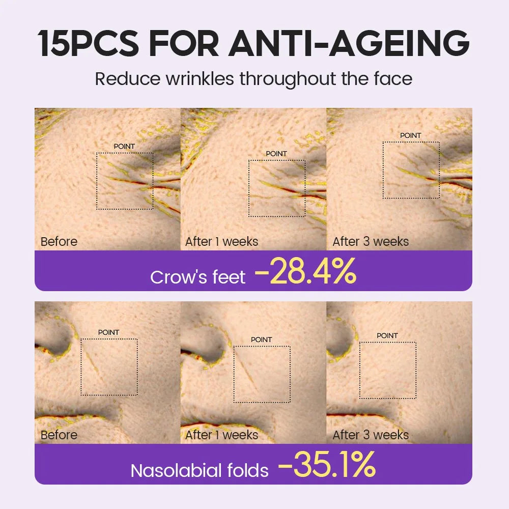 Retinol + Pro-xylane Ampoule serum  Repairs Strengthens The Skin And Diminishes Fine Lines Face Beauty Skin Care 15pcs - LKBA