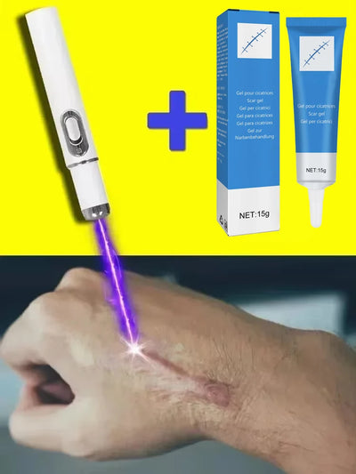 Laser Therapy Keloid Scar Improve Keloid Scar Pen Scar Relief Easy Harmless Laser Pointer - LKBA
