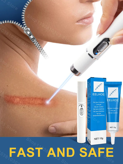 Laser Therapy Keloid Scar Improve Keloid Scar Pen Scar Relief Easy Harmless Laser Pointer - LKBA