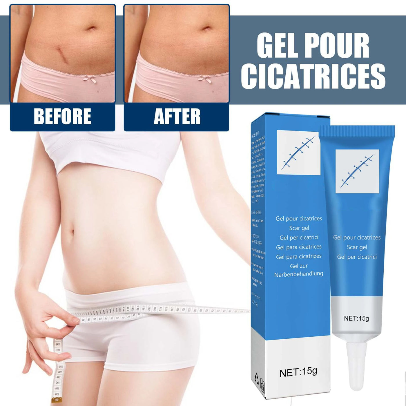 Laser Therapy Keloid Scar Improve Keloid Scar Pen Scar Relief Easy Harmless Laser Pointer - LKBA