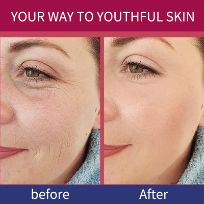 Korean Bio Collagen Anti-aging Face Mask Hyaluronic Acid Deep Hydrating Moisturizing Whitening Lightening Facial Skin Care - LKBA