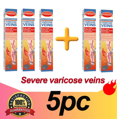 Body care, leg care tools, blue light pen, varicose veins, hot sale in 2025 - LKBA