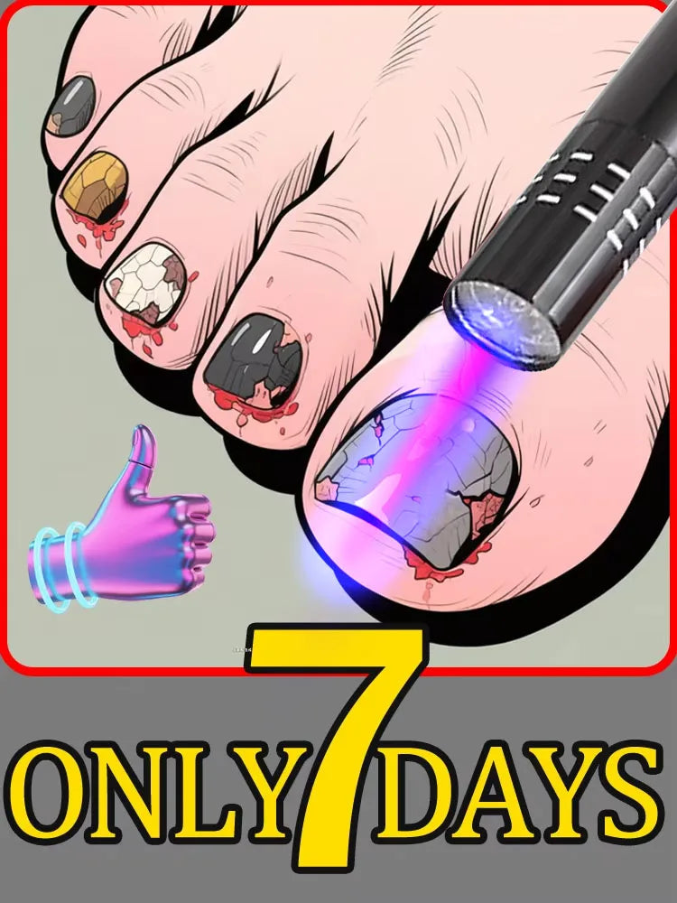 Nail repair blue light, nail care tools - LKBA