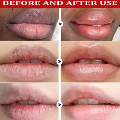 Fast Remove Dark Lip Balm Serum Lighten Melanin Lip Mask Exfoliating Fade Lip Lines Dead Skin Nourishing Repair Lip Care Makeup - LKBA