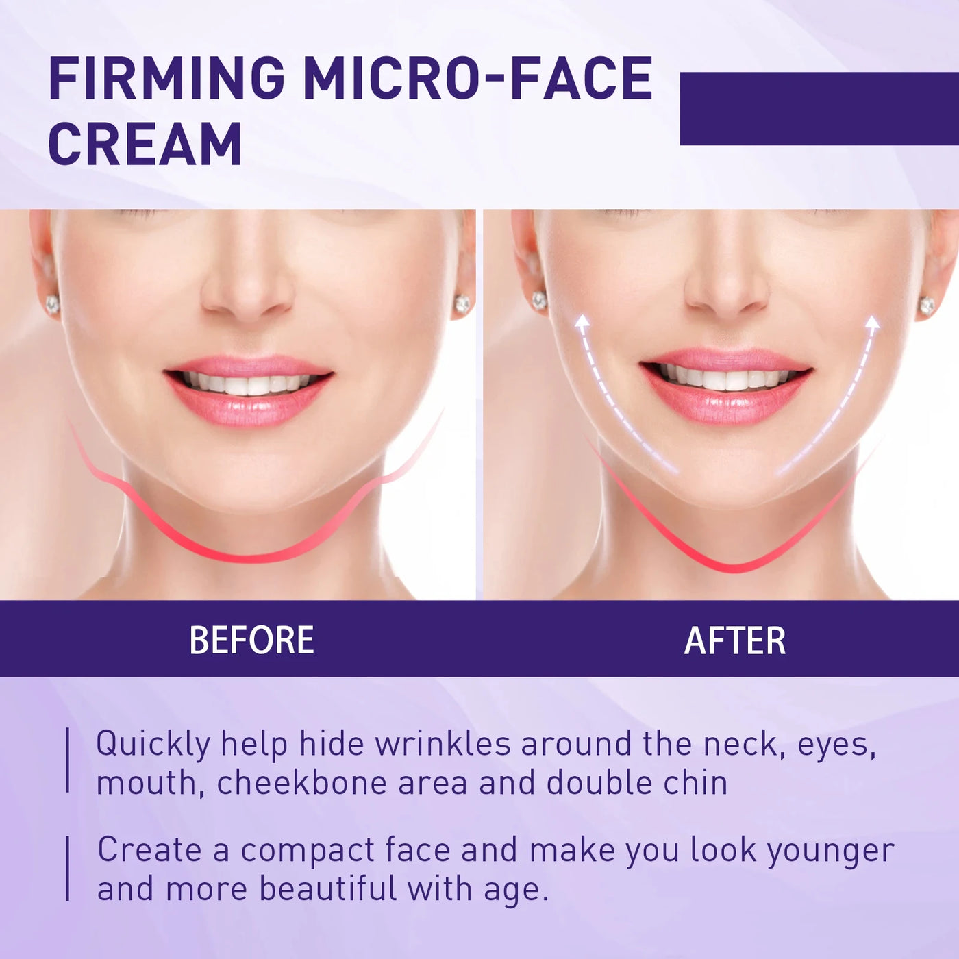 Double Chin V Shape Remove The face fat - LKBA