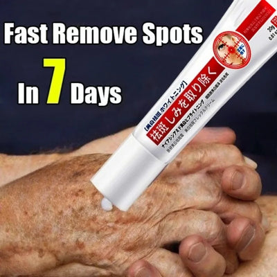 Mild niacinamide whitening and blemish cream, lightens melanin dull pigment, moisturizes skin care - LKBA