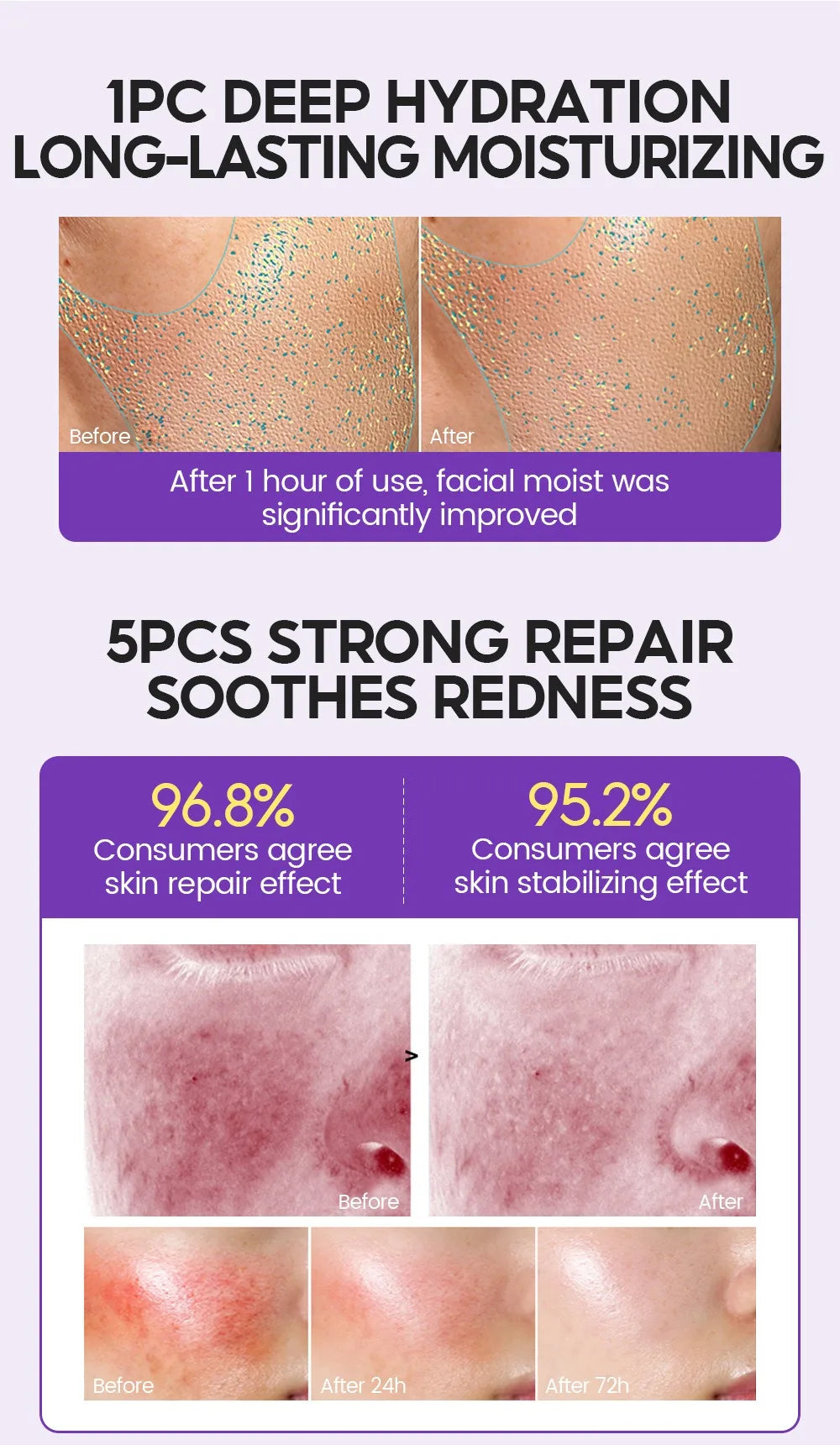 Retinol + Pro-xylane Ampoule serum  Repairs Strengthens The Skin And Diminishes Fine Lines Face Beauty Skin Care 15pcs - LKBA