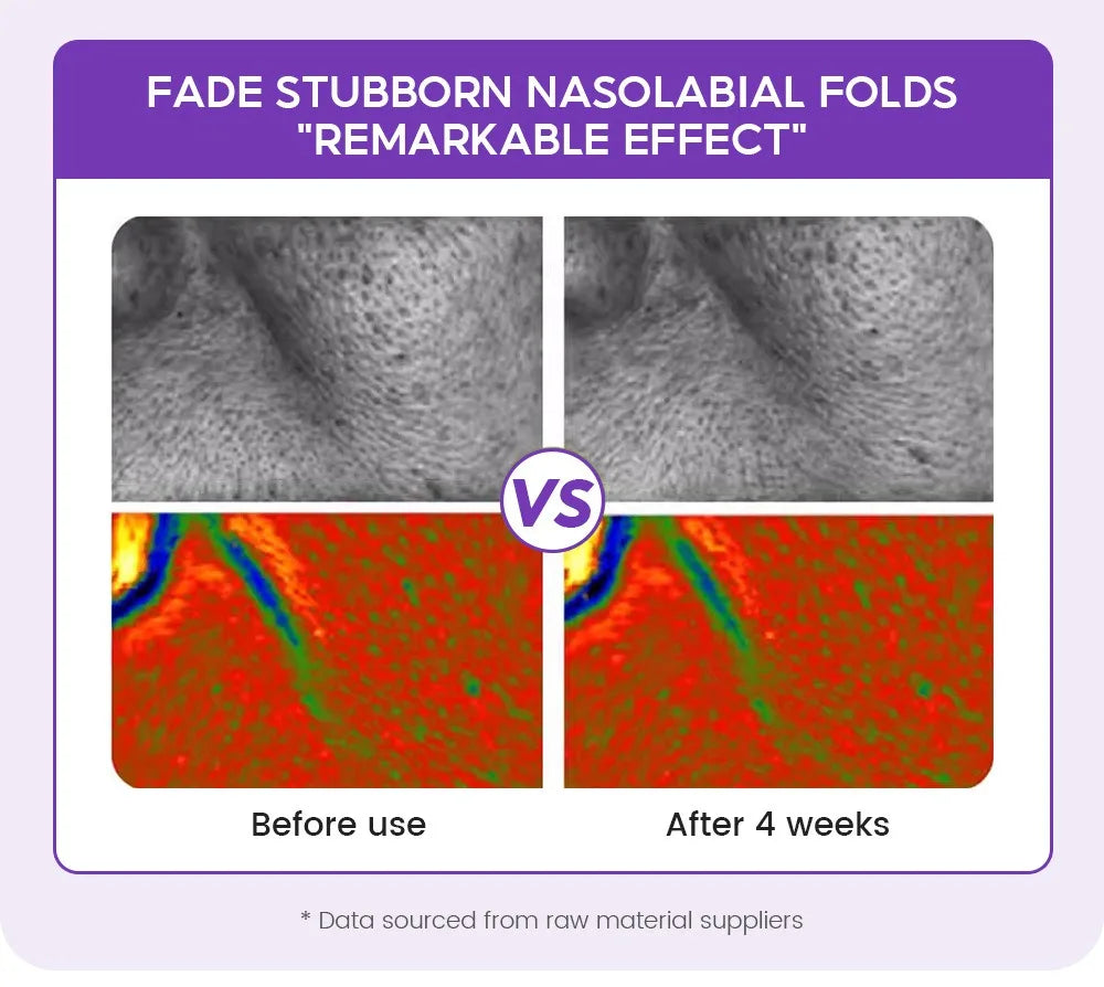 Retinol + Pro-xylane Ampoule serum  Repairs Strengthens The Skin And Diminishes Fine Lines Face Beauty Skin Care 15pcs - LKBA