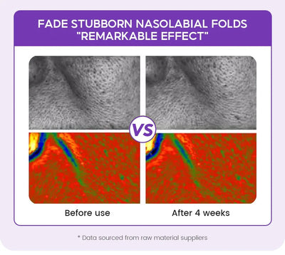 Retinol + Pro-xylane Ampoule serum  Repairs Strengthens The Skin And Diminishes Fine Lines Face Beauty Skin Care 15pcs - LKBA