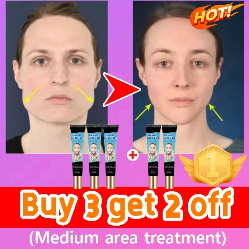 Double Chin V Shape Remove The face fat - LKBA