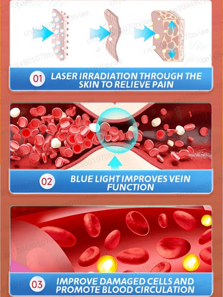 Body care, leg care tools, blue light pen, varicose veins, hot sale in 2025 - LKBA