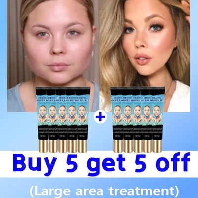 Double Chin V Shape Remove The face fat - LKBA