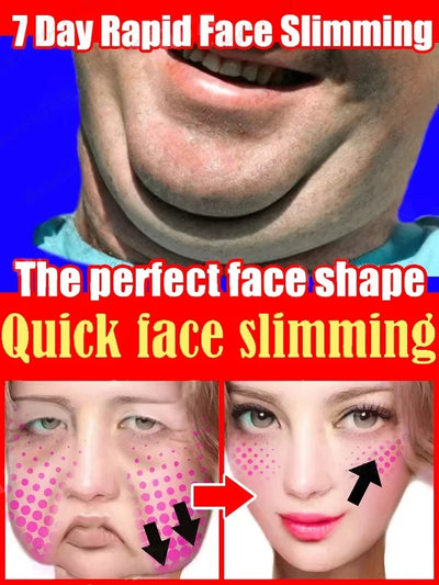 Double Chin V Shape Remove The face fat - LKBA