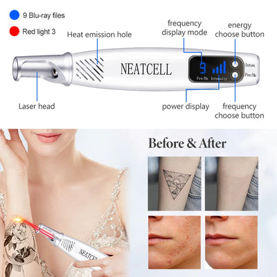 Picosecond Laser Pointer for Mole Removal  Dark Spot Removal Pen Tattoo Acne Skin Pigment Portable Removal Machine Beauty Device - LKBA