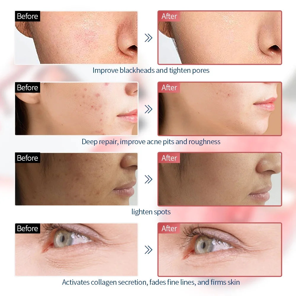 Wireless 7 Colors Face LED Mask Photon Facal Beauty Mask Skin Rejuvenation Anti Acne Repair Skin Tightening Anti Aging Skin Care - LKBA