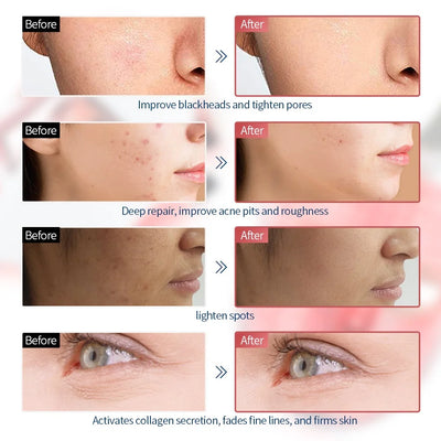 Wireless 7 Colors Face LED Mask Photon Facal Beauty Mask Skin Rejuvenation Anti Acne Repair Skin Tightening Anti Aging Skin Care - LKBA