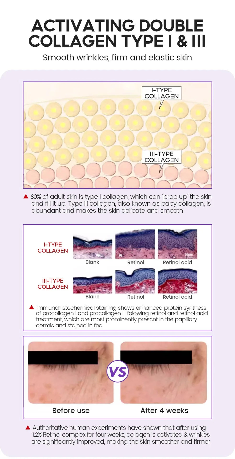 Retinol + Pro-xylane Ampoule serum  Repairs Strengthens The Skin And Diminishes Fine Lines Face Beauty Skin Care 15pcs - LKBA