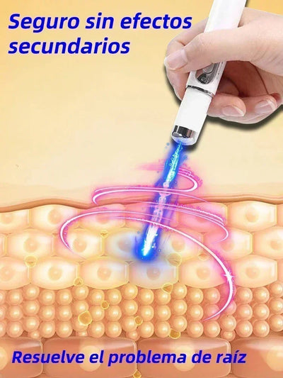 Laser Therapy Keloid Scar Improve Keloid Scar Pen Scar Relief Easy Harmless Laser Pointer - LKBA