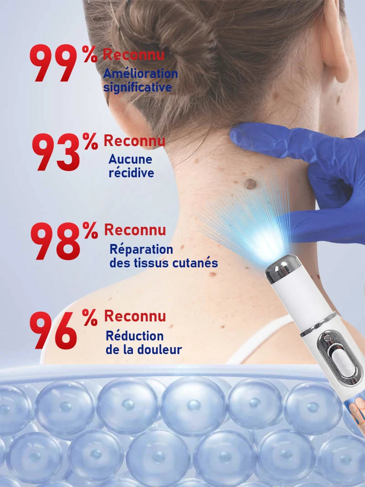 Outil Wart Blue Light, plus de réductions sur les ensembles - LKBA