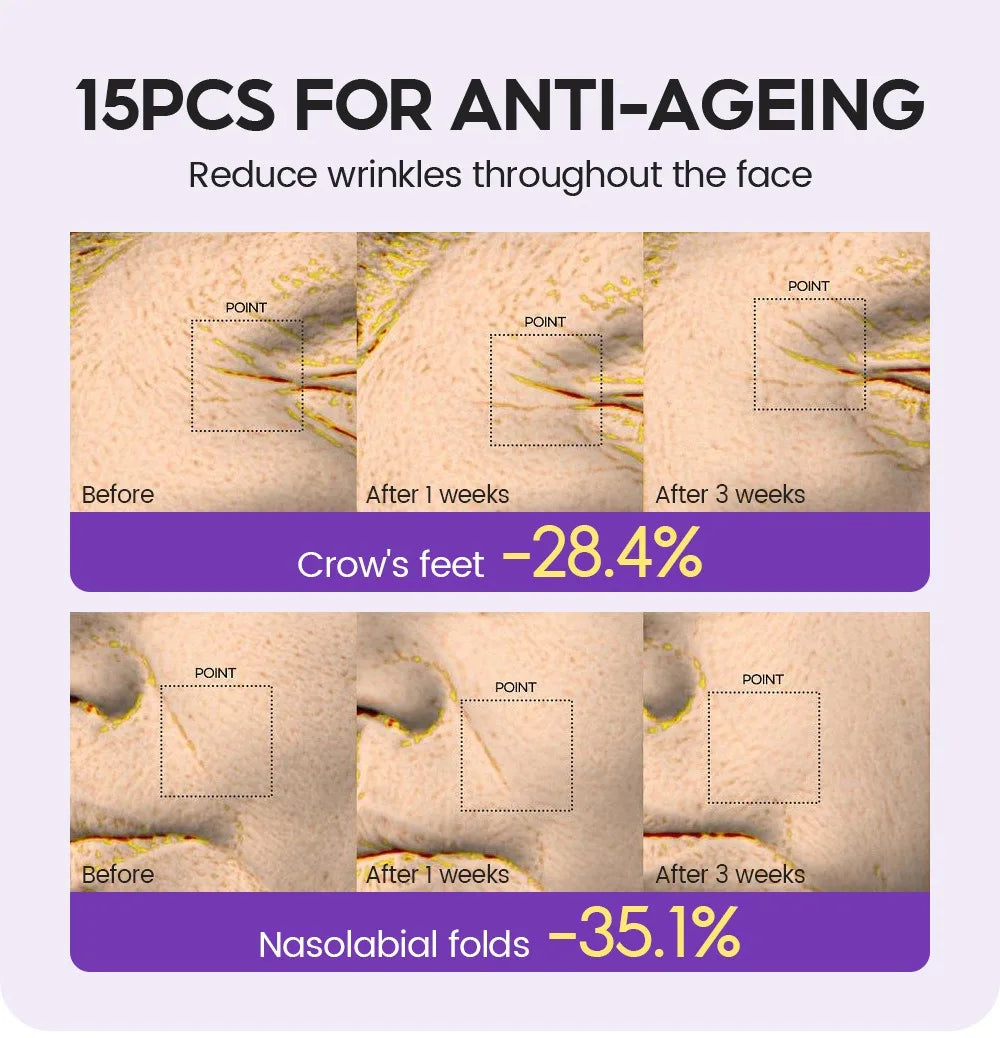 Retinol + Pro-xylane Ampoule serum  Repairs Strengthens The Skin And Diminishes Fine Lines Face Beauty Skin Care 15pcs - LKBA