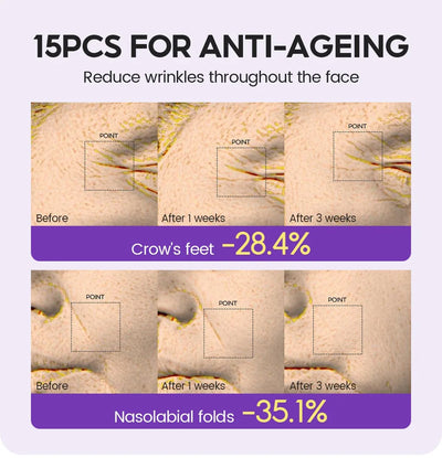 Retinol + Pro-xylane Ampoule serum  Repairs Strengthens The Skin And Diminishes Fine Lines Face Beauty Skin Care 15pcs - LKBA