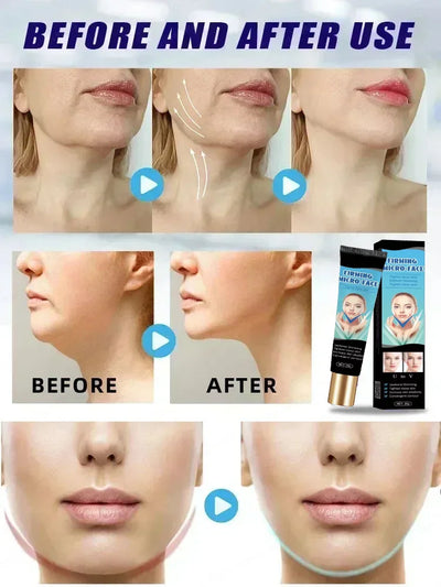 Double Chin V Shape Remove The face fat - LKBA