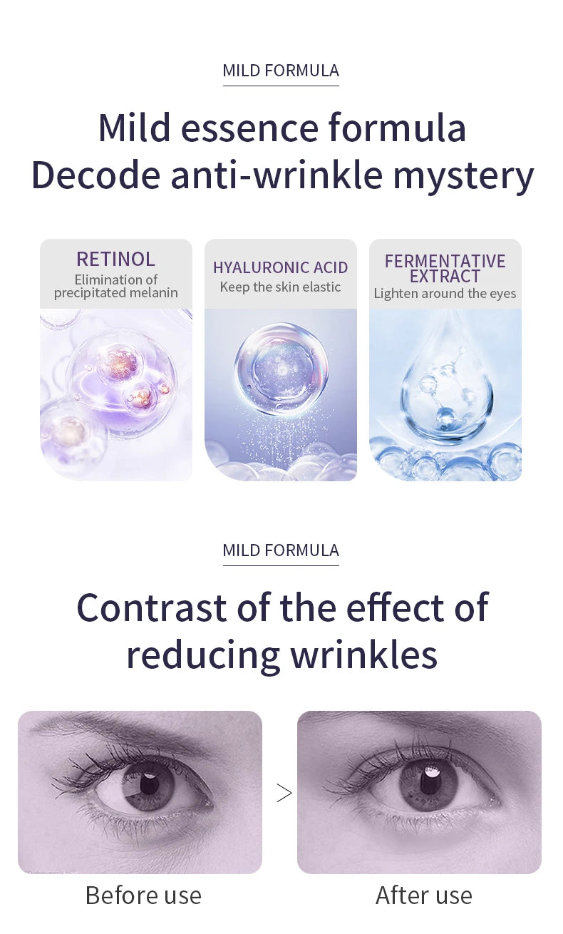 Anti-Wrinkle Anti Dark Circle Eye Cream Roller Massager Moisturizing Eye Bags Anti-Aging Hyaluronic Acid Eye Skin Care - LKBA