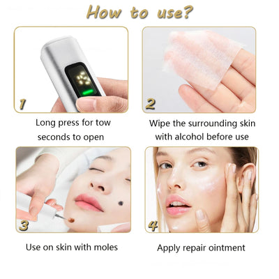 Laser Plasma Pen Black Dots Warts Remover Skin Tag Remover Mole Wart Eliminator Dark Spots - LKBA