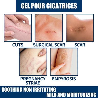 Laser Therapy Keloid Scar Improve Keloid Scar Pen Scar Relief Easy Harmless Laser Pointer - LKBA