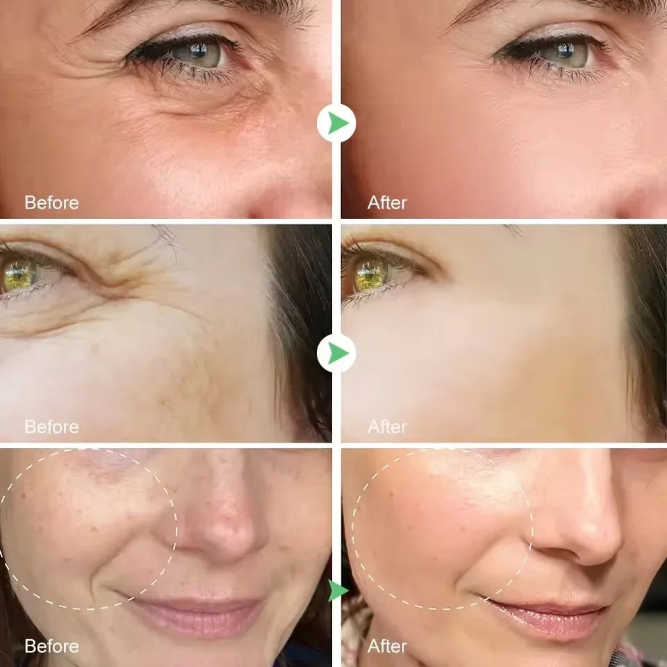 Remove Wrinkle Face Serum Lift Firming Anti-Aging Fade Fine Lines Whitening Brightening Moisturizer Skin Care - LKBA
