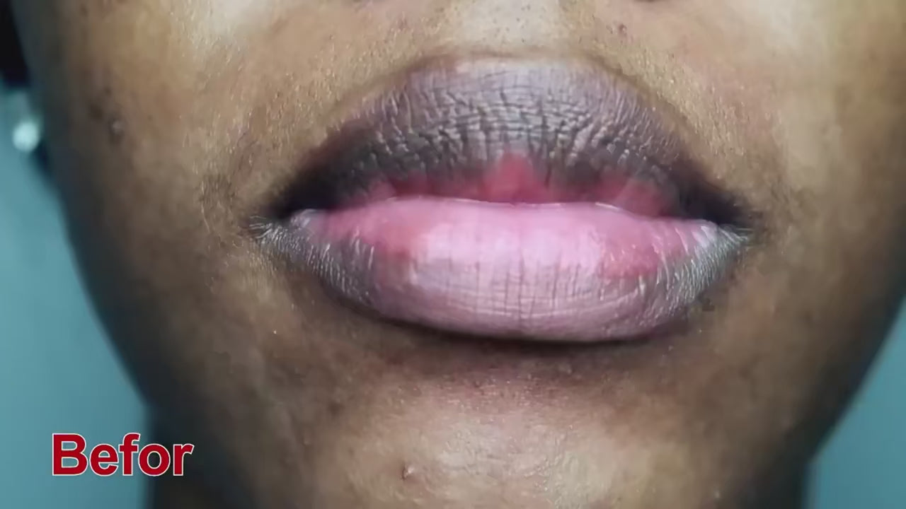 Fast Remove Dark Lip Balm Serum Lighten Melanin Lip Mask Exfoliating Fade Lip Lines Dead Skin Nourishing Repair Lip Care Makeup