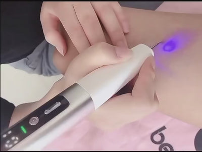 Laser Plasma Pen Black Dots Warts Remover Skin Tag Remover Mole Wart Eliminator Dark Spots